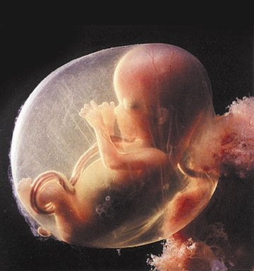 China Female Infanticide